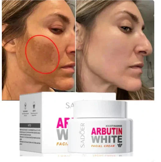 🎁 ¡Llévate 3 Cremas Arbutin White + 1 Crema Elixir Antiedad GRATIS! ✨ Piel Más Clara y Joven en Días