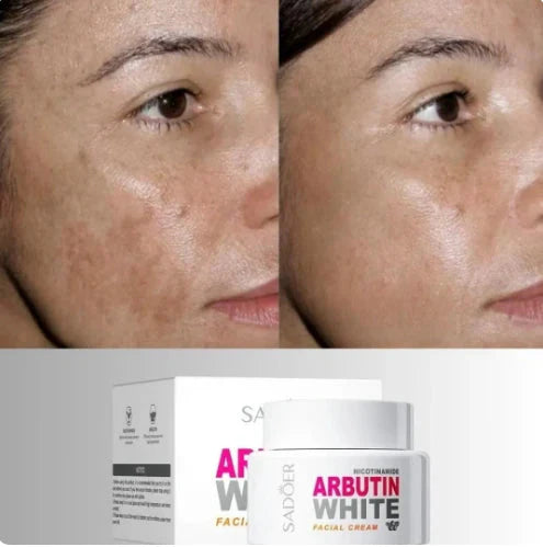 🎁 ¡Llévate 3 Cremas Arbutin White + 1 Crema Elixir Antiedad GRATIS! ✨ Piel Más Clara y Joven en Días